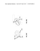 Femoral Heads, Mobile Inserts, Acetabular Components, and Modular     Junctions for Orthopedic Implants and Methods of Using Femoral Heads,     Mobile Insets, Acetabular Components, and Modular Junctions for     Orthopedic Implants diagram and image