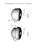 Femoral Heads, Mobile Inserts, Acetabular Components, and Modular     Junctions for Orthopedic Implants and Methods of Using Femoral Heads,     Mobile Insets, Acetabular Components, and Modular Junctions for     Orthopedic Implants diagram and image