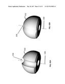 Femoral Heads, Mobile Inserts, Acetabular Components, and Modular     Junctions for Orthopedic Implants and Methods of Using Femoral Heads,     Mobile Insets, Acetabular Components, and Modular Junctions for     Orthopedic Implants diagram and image