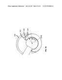 Femoral Heads, Mobile Inserts, Acetabular Components, and Modular     Junctions for Orthopedic Implants and Methods of Using Femoral Heads,     Mobile Insets, Acetabular Components, and Modular Junctions for     Orthopedic Implants diagram and image