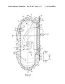 OSTOMY APPLIANCE diagram and image