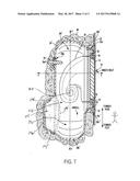 OSTOMY APPLIANCE diagram and image