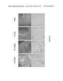 METHODS AND COMPOSITIONS OF BILE ACIDS AND SALTS FOR REDUCTION OF FAT diagram and image