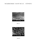 BONE MATRIX COMPOSITIONS HAVING NANOSCALE TEXTURED SURFACES diagram and image