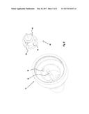 INJECTION NEEDLE ASSEMBLY diagram and image