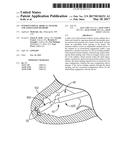 INTERVENTIONAL MEDICAL SYSTEMS AND ASSOCIATED METHODS diagram and image