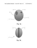 An Implantable Stimulation Device diagram and image