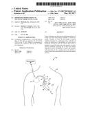 PRIORITIZED PROGRAMMING OF MULTI-ELECTRODE PACING LEADS diagram and image