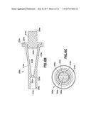 FLUID PATH SET WITH TURBULENT MIXING CHAMBER, BACK FLOW COMPENSATOR diagram and image