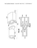 FLUID PATH SET WITH TURBULENT MIXING CHAMBER, BACK FLOW COMPENSATOR diagram and image