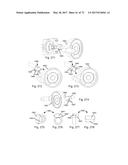 BLADE ELEVATION MECHANISMS AND ANTI-BACKDRIVE MECHANISMS FOR TABLE SAWS diagram and image