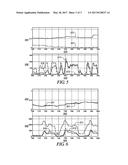 METHOD AND APPARATUS TO CONTROL REDUCTANT INJECTION INTO AN EXHAUST GAS     FEEDSTREAM diagram and image