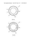 EXHAUST DEVICE OF ENGINE diagram and image