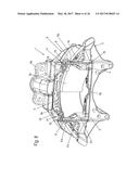 Disc Brake and Brake Pad Set diagram and image