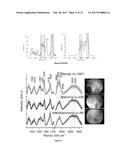 RAMAN SPECTROSCOPY SYSTEM, APPARATUS, AND METHOD FOR ANALYZING,     CHARACTERIZING, AND/OR DIAGNOSING A TYPE OR NATURE OF A SAMPLE OR A     TISSUE SUCH AS AN ABNORMAL GROWTH diagram and image