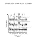 RAMAN SPECTROSCOPY SYSTEM, APPARATUS, AND METHOD FOR ANALYZING,     CHARACTERIZING, AND/OR DIAGNOSING A TYPE OR NATURE OF A SAMPLE OR A     TISSUE SUCH AS AN ABNORMAL GROWTH diagram and image