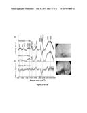 RAMAN SPECTROSCOPY SYSTEM, APPARATUS, AND METHOD FOR ANALYZING,     CHARACTERIZING, AND/OR DIAGNOSING A TYPE OR NATURE OF A SAMPLE OR A     TISSUE SUCH AS AN ABNORMAL GROWTH diagram and image