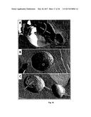 Nanoveson(TM): Treatment, Biomarkers and Diagnostic Tests for Liver     Diseases and Comormid Disease diagram and image