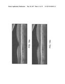 SEGMENTATION AND IDENTIFICATION OF LAYERED STRUCTURES IN IMAGES diagram and image