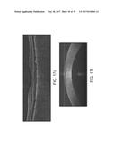 SEGMENTATION AND IDENTIFICATION OF LAYERED STRUCTURES IN IMAGES diagram and image