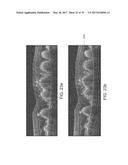 SEGMENTATION AND IDENTIFICATION OF LAYERED STRUCTURES IN IMAGES diagram and image