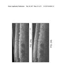 SEGMENTATION AND IDENTIFICATION OF LAYERED STRUCTURES IN IMAGES diagram and image