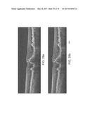 SEGMENTATION AND IDENTIFICATION OF LAYERED STRUCTURES IN IMAGES diagram and image