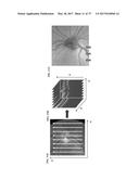 Method And Apparatus For Motion Correction And Image Enhancement For     Optical Coherence Tomography diagram and image