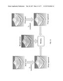 Method And Apparatus For Motion Correction And Image Enhancement For     Optical Coherence Tomography diagram and image