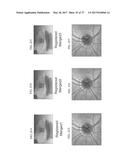 Method And Apparatus For Motion Correction And Image Enhancement For     Optical Coherence Tomography diagram and image