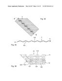 BIPOLAR PLATES FOR LIMITING THE BYPASSING OF THE FLOW CHANNELS BY THE     REACTANTS diagram and image