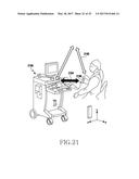 SIGNAL RADIATION DEVICE IN TRANSMISSION DEVICE diagram and image