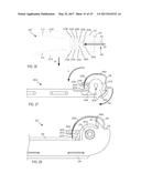 SUTURE REPAIR DEVICE diagram and image