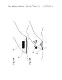 SURGICAL APPARATUS, METHOD FOR USING THE SURGICAL APPARATUS AND SUTURE     METHOD diagram and image