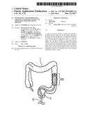 INSTRUMENTS AND METHODS FOR TREATING ULCERATIVE COLITIS AND OTHER     INFLAMMATORY BOWEL DISEASES diagram and image