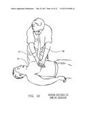 OPTICAL TECHNIQUES FOR THE MEASUREMENT OF CHEST COMPRESSION DEPTH AND     OTHER PARAMETERS DURING CPR diagram and image