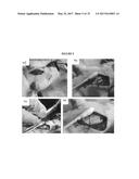 IN VIVO LIVE 3D PRINTING OF REGENERATIVE BONE HEALING SCAFFOLDS FOR RAPID     FRACTURE HEALING diagram and image