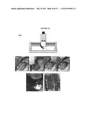 IN VIVO LIVE 3D PRINTING OF REGENERATIVE BONE HEALING SCAFFOLDS FOR RAPID     FRACTURE HEALING diagram and image