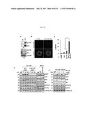 USE OF COMPOUNDS INHIBITING APELIN / APJ / GP130 SIGNALING FOR TREATING     CANCER diagram and image