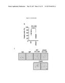 USE OF COMPOUNDS INHIBITING APELIN / APJ / GP130 SIGNALING FOR TREATING     CANCER diagram and image