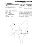 PRESSURE DISTRIBUTION ELEMENT HOLDING A RING FOR CHEST HARNESSES diagram and image