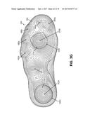 Articles of Footwear and Sole Structures for Articles of Footwear diagram and image