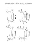 Articles of Footwear and Sole Structures for Articles of Footwear diagram and image