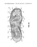 Articles of Footwear and Sole Structures for Articles of Footwear diagram and image