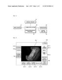 METHOD FOR MEASURING SIZE OF LESION WHICH IS SHOWN BY ENDOSCOPE, AND     COMPUTER READABLE RECORDING MEDIUM diagram and image