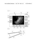 METHOD FOR MEASURING SIZE OF LESION WHICH IS SHOWN BY ENDOSCOPE, AND     COMPUTER READABLE RECORDING MEDIUM diagram and image