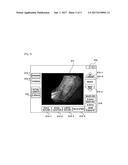 METHOD FOR MEASURING SIZE OF LESION WHICH IS SHOWN BY ENDOSCOPE, AND     COMPUTER READABLE RECORDING MEDIUM diagram and image