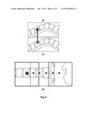 IMAGING SYSTEM FOR A VERTEBRAL LEVEL diagram and image