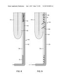 METHODS AND DEVICES FOR MANIPULATING AND FASTENING TISSUE diagram and image