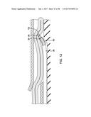 METHODS AND DEVICES FOR MANIPULATING AND FASTENING TISSUE diagram and image